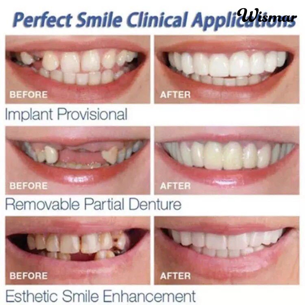 Bộ 2 hàm răng giả trên và dưới tiện lợi