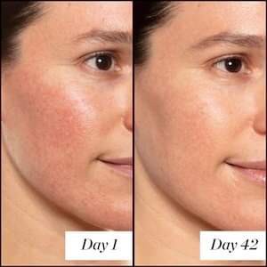 SUNDAY RILEY Gói Tinh chất chống lão hoá A+ High-Dose Retinol Serum 1ml NỘI ĐỊA MỸ