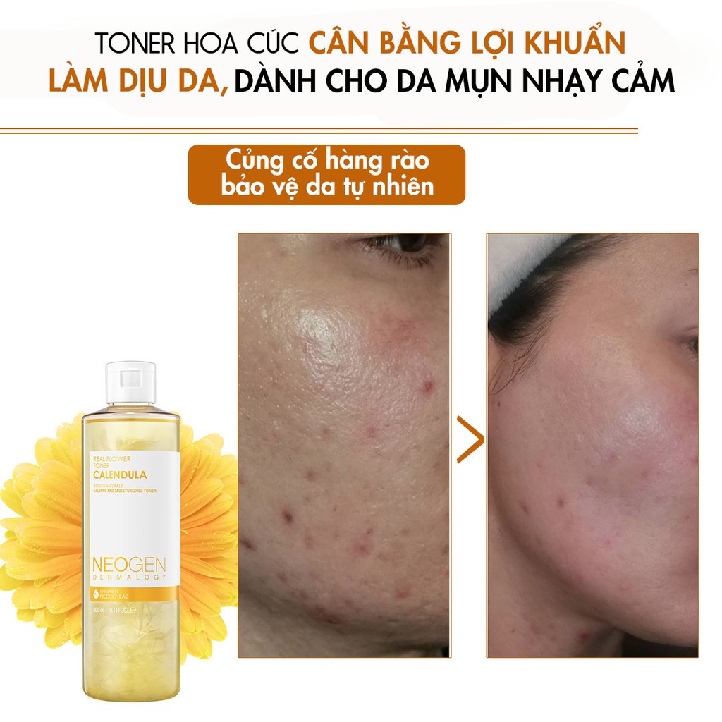 Toner Hoa Cúc Cân Bằng Làm Dịu Da, Siêu Cấp Ẩm Cho Da Mụn Nhạy Cảm Neogen Dermalogy 300ml