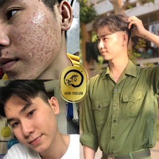 Combo Hoàng Thiên Sâm - Tái Tạo Da