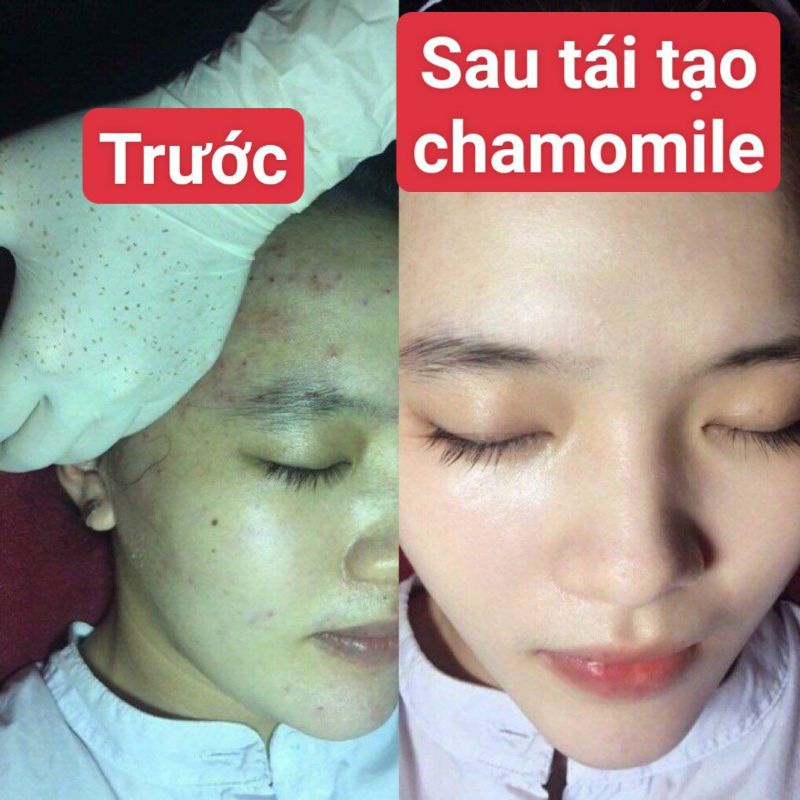Kem tái tạo chamomile hồng sâm