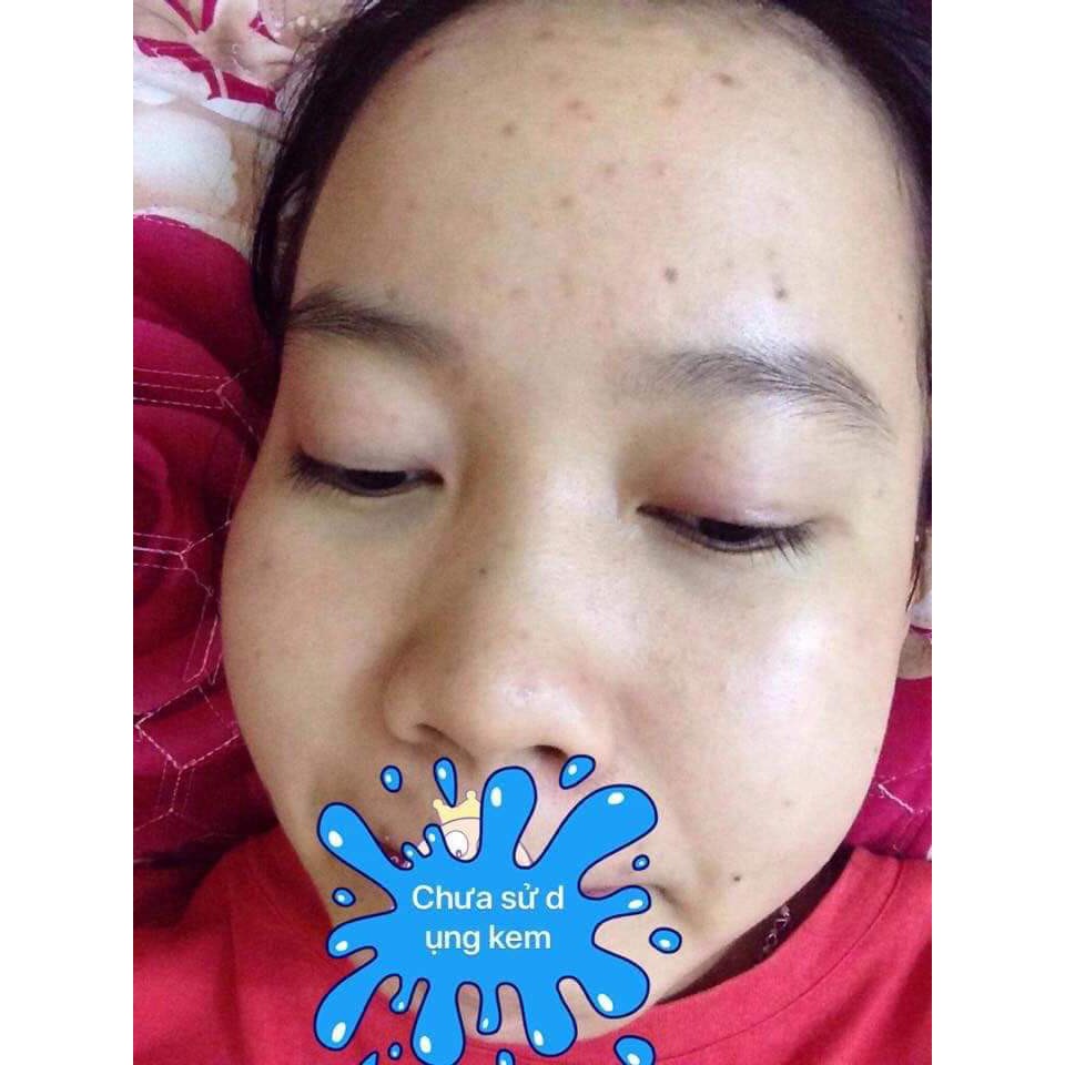 Kem hoa cúc pau jen pai(1 ngày 1 đêm) | BigBuy360 - bigbuy360.vn