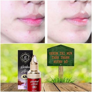 CHẤM MỤN 12H HUỲNH ĐỖ