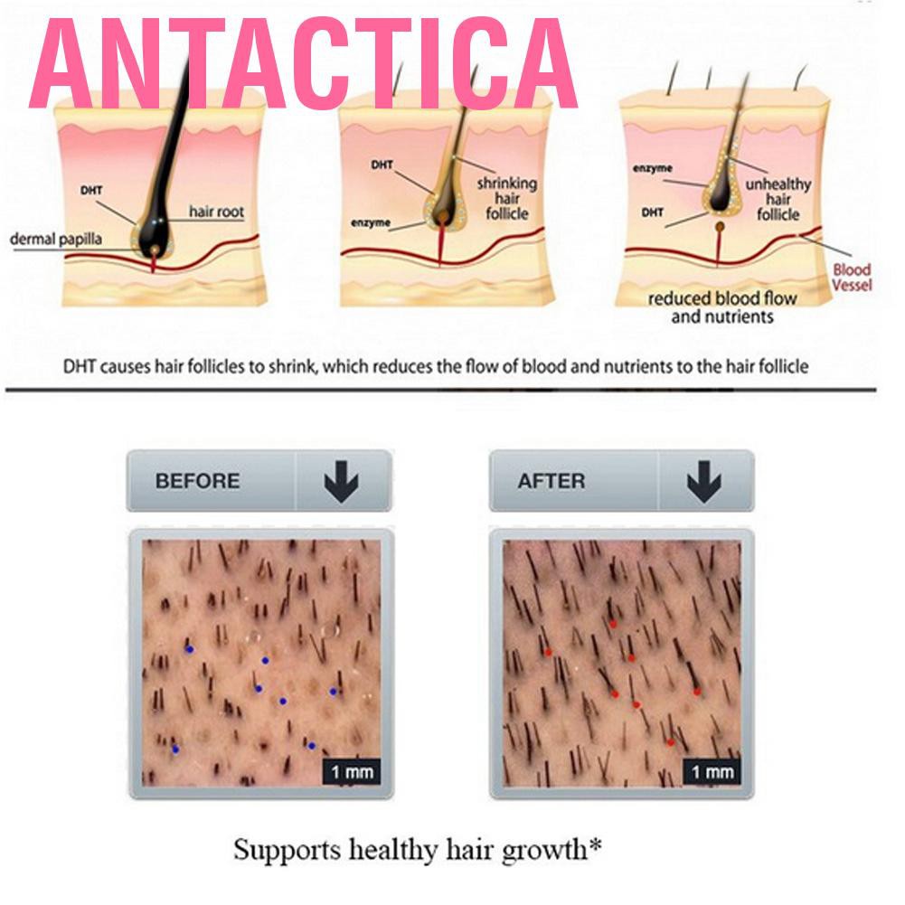 Antactica Ginger Shampoo  Conditioner Improve Nourishing Hair Care Growth Prevent Loss for Dandruff Itchy Flaky or Dry Scalp
