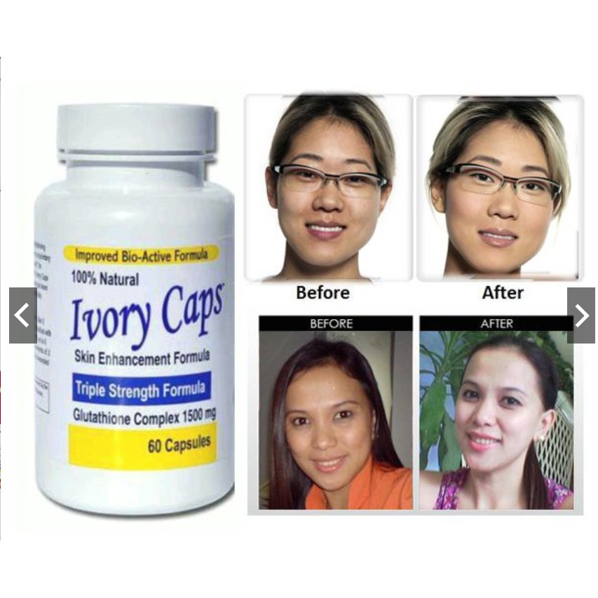 Viên Uống vory trắng da, giảm nám, tàn nhang Ivory Caps | BigBuy360 - bigbuy360.vn