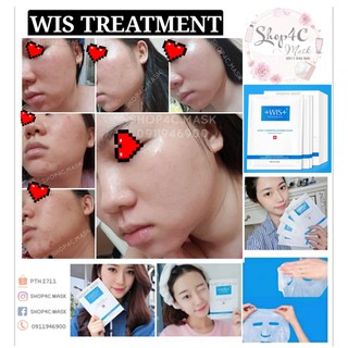WIS Mặt nạ giảm mụn kiềm dầu se lỗ chân lông cấp nước phục hồi căng bóng +Wis+ mask
