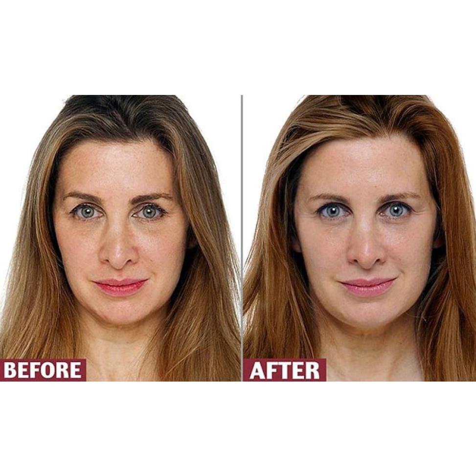 Viên Uống Retinol Myvitamins UK Hộp 90 viên giảm lão hóa giúp đẹp da