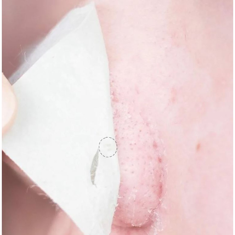 1 Miếng] Miếng Dán Lột Mụn Đầu Đen Chiết Xuất Tràm Trà Hatherine Pore Clear Calming | BigBuy360 - bigbuy360.vn