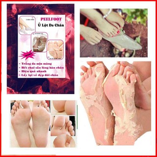 Ủ chân lột trắng da hết chai sần