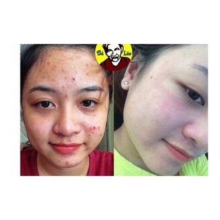 Sáng Da Aqua Collagen Bà Lão