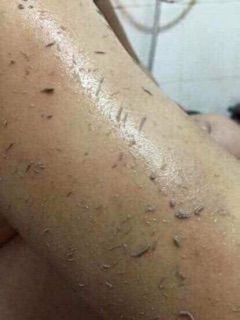 GEL TẨY TBC SPA