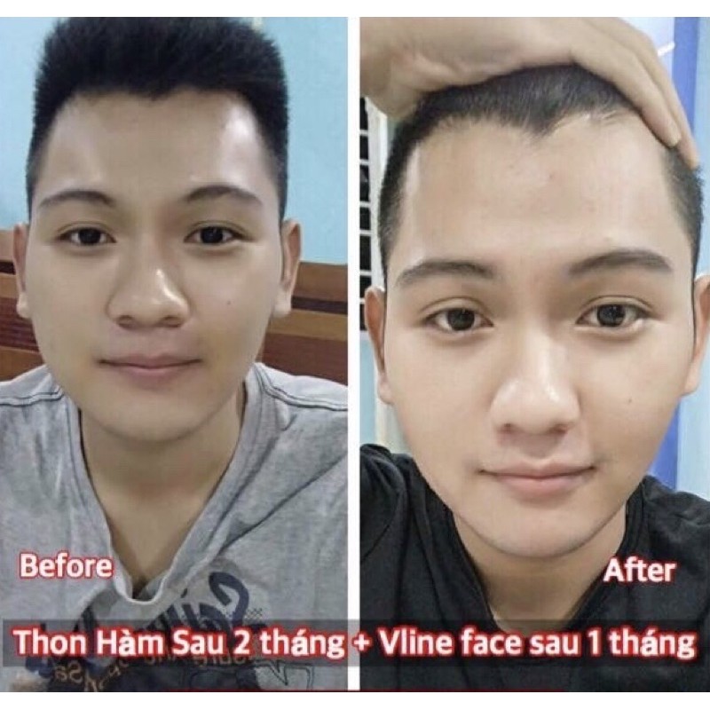 Serum tinh chất thon gọn xương, tạo mặt Vine face - Hàn Quốc (20ml)