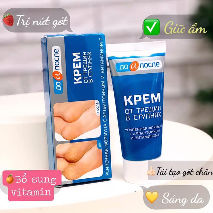 Kem Trị Nứt Gót Chân Kpem Apteka Nga