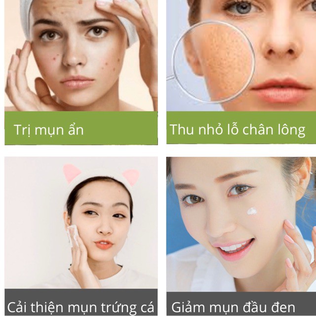 Toner Hỗ Trợ Giảm Mụn Ẩn Thu Nhỏ Lỗ Chân Lông Tái Tạo Da Verbena Ketone Rosemary Yingchun