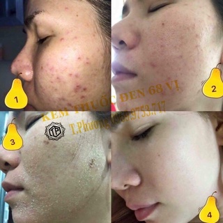 kem đông y 300gr handmade