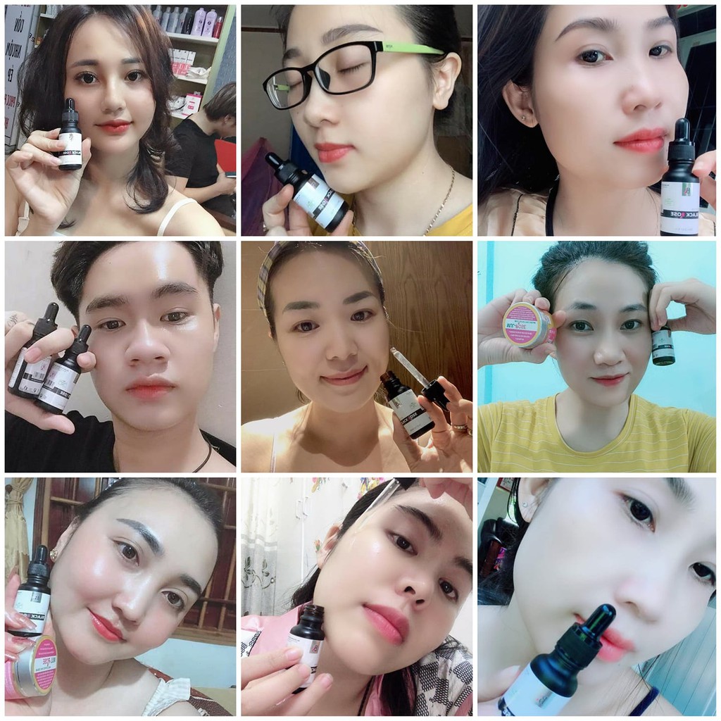 / Chính Hãng / Serum Black Rose dưỡng Trắng Sáng da & Giảm Thâm Mụn