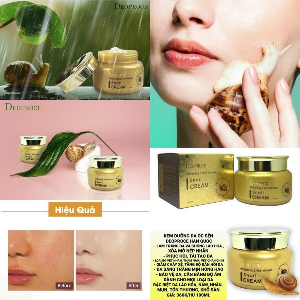 Kem DEOPROCE làm trắng và chống nếp nhăn thành phần từ dịch nhầy ốc sên 100 ml