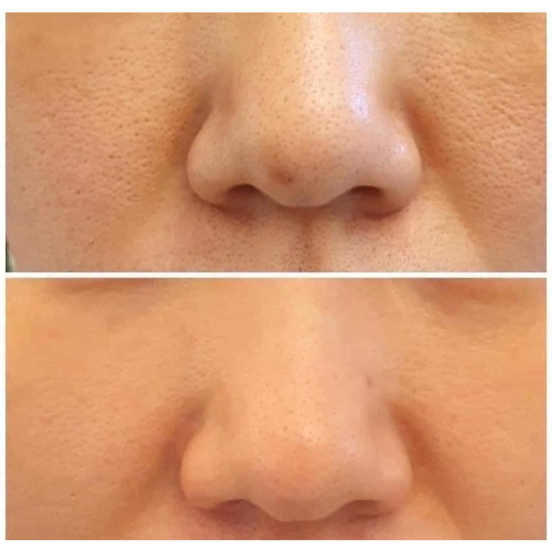 Tinh chất 𝐍𝐢𝐚𝐜𝐢𝐧𝐚𝐦𝐢𝐝𝐞 𝟐𝟎% DERMA FACTORY 30ml