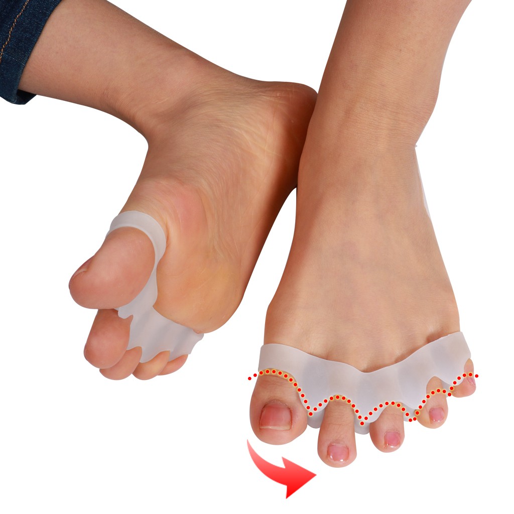 Dụng cụ tách ngón chân để giảm đau và chỉnh hình ngón chân cái