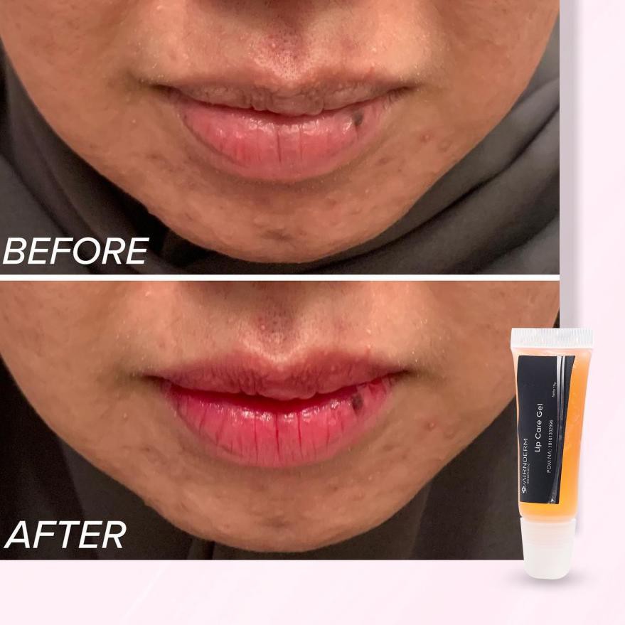(Hàng Mới Về) Son Môi Dạng Gel Airnderm Chăm Sóc Môi | BigBuy360 - bigbuy360.vn