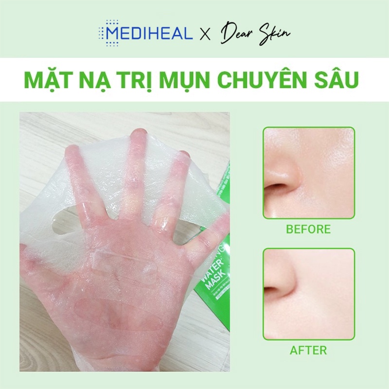 [Chính hãng] Mặt nạ Mediheal dưỡng da căng mịn, mọng nước, làm đều màu, sáng mịn da, ngăn ngừa các nếp nhăn và lão hóa