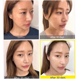 Serum Quýt Yuja Niacin Some By Mi