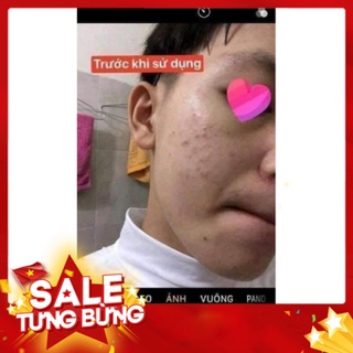 Combo tri mun Dr mai [CHÍNH HÃNG] ✅