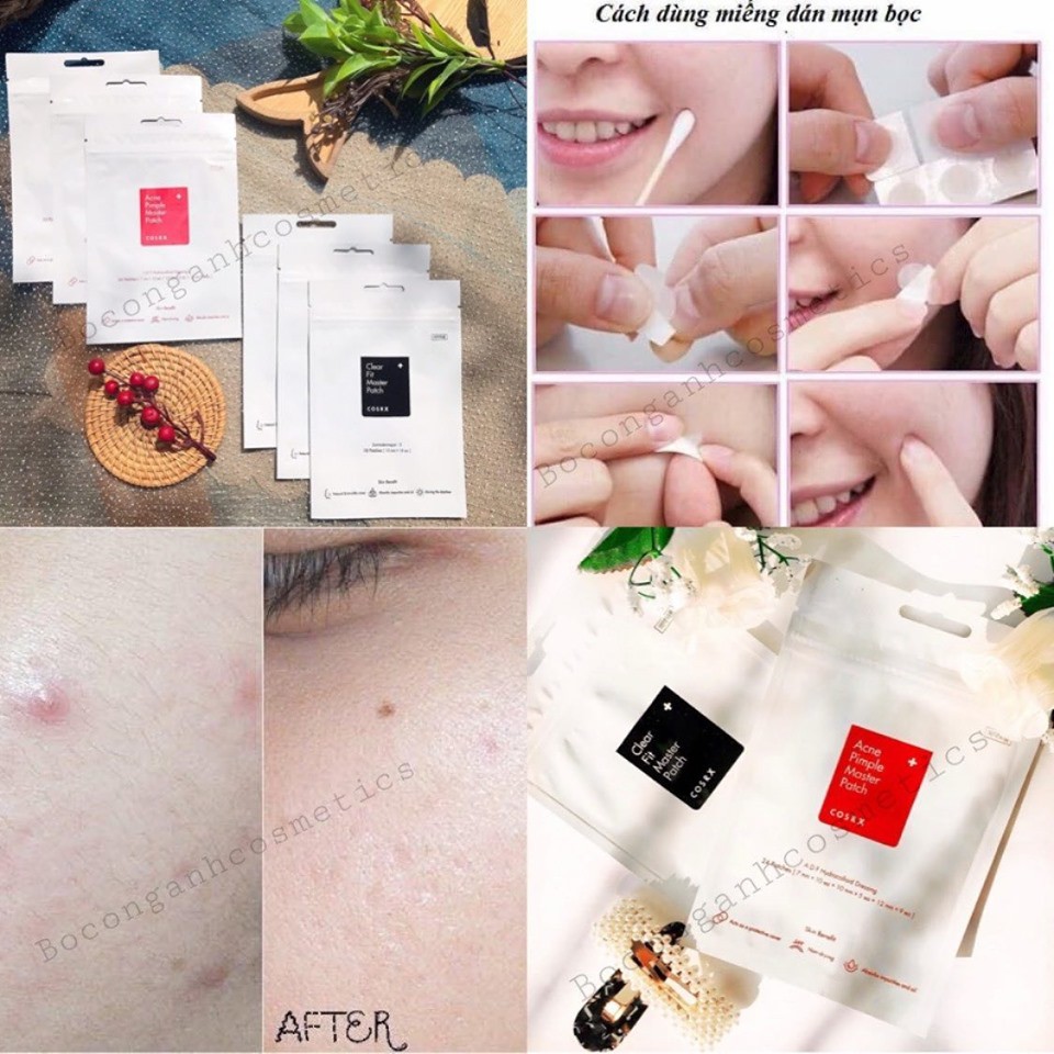 MIẾNG DÁN MỤN COSRX ACNE PIMPLE MASTER PATCH (SẴN)