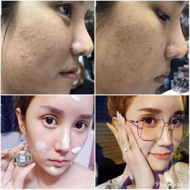 Kem Collagen 4k Plus Thái Lan loại 1 | BigBuy360 - bigbuy360.vn