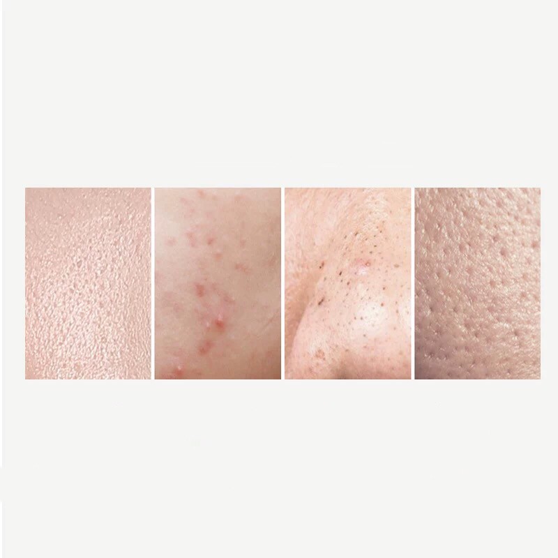 Nước hoa hồng SOWBAF kiềm dầu dưỡng ẩm giảm mụn Salicylic Acid Oil Control And Moisturizing Skin Toner SOBA05 | BigBuy360 - bigbuy360.vn