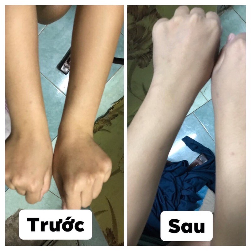 KEM TẮM TRẮNG TOÀN THÂN CAO CẤP 6 IN 1 - BODY WHITE SHOWER 6 IN 1 | BigBuy360 - bigbuy360.vn