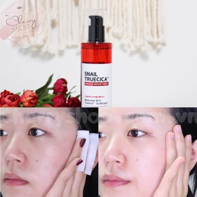 Bộ dưỡng da ốc sên Some By Mi Snail Truecica Miracle Repair Starter Kit