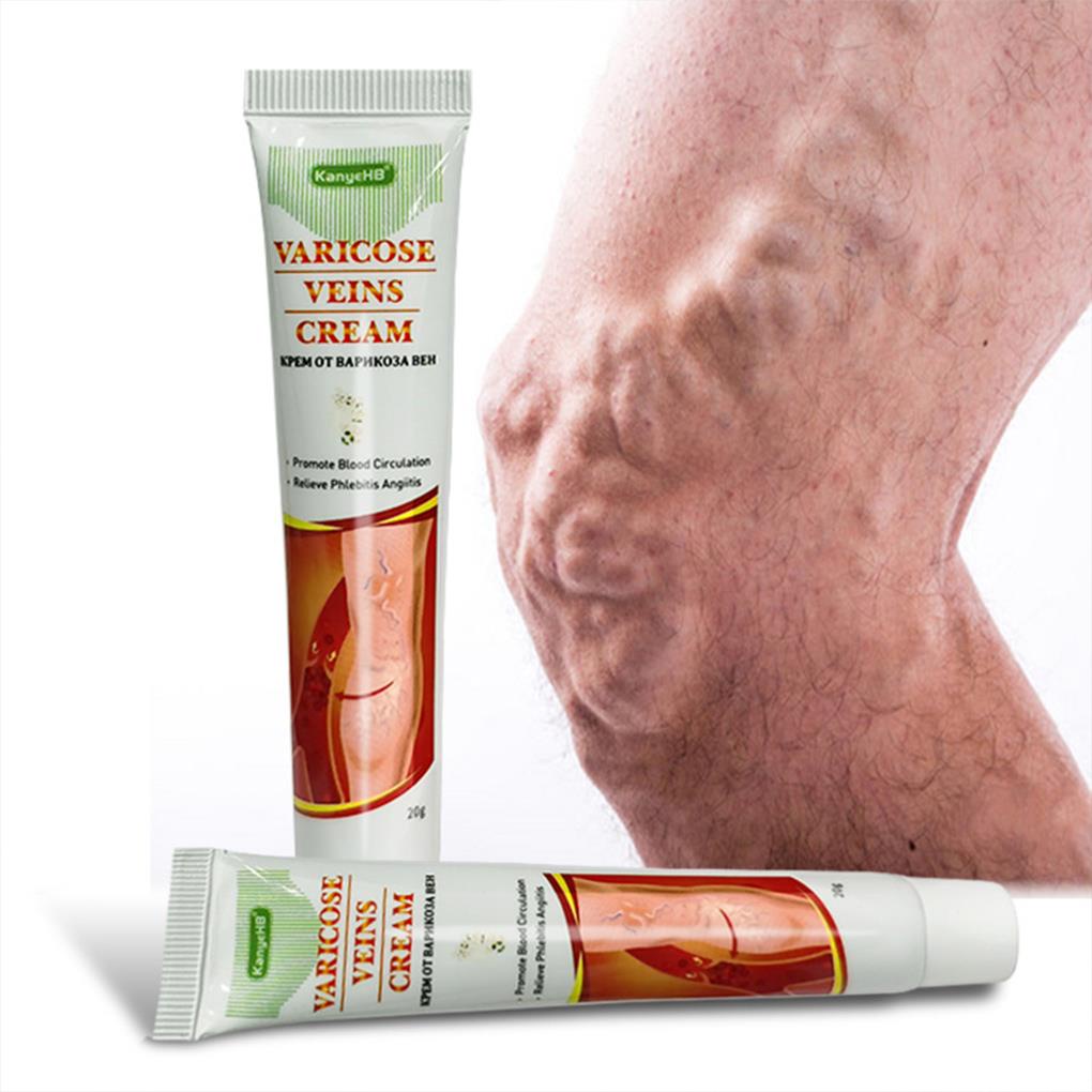 [Hàng mới về] Set 2 tuýp kem bôi kích thích tuần hoàn máu ngăn giãn tĩnh mạch chăm sóc chân/ toàn thân