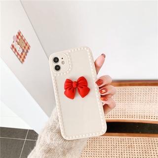 Ốp lưng iphone silicon nơ đáng yêu tiểu thư