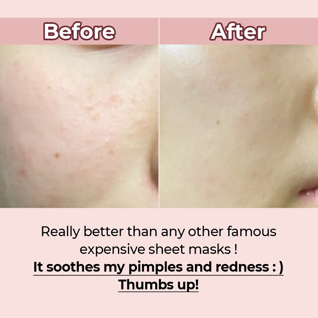 Mặt nạ se lỗ chân lông NUMBUZIN NO3 TINGLE PORE SOFTENING MASK SHEET