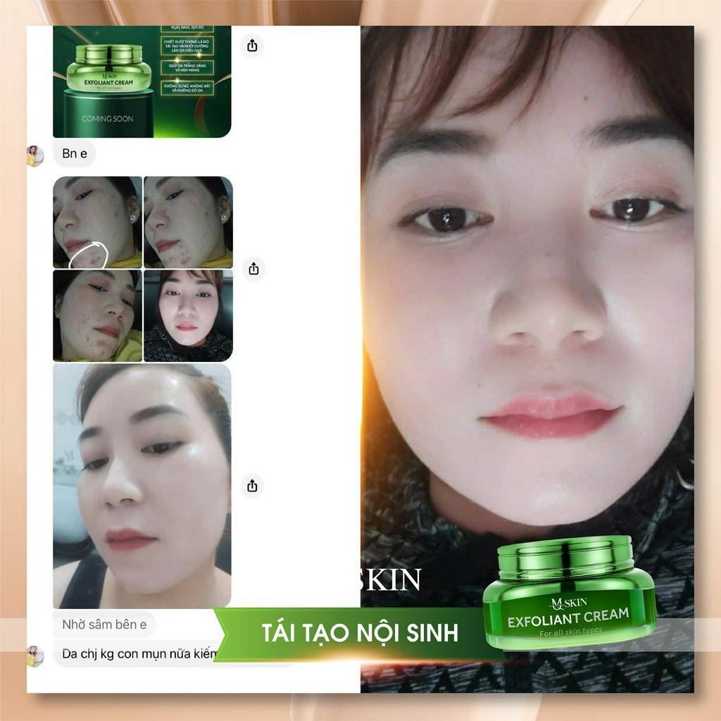 Kem Tái Tạo Nội Sinh MQ SKIN Chính Hãng không sưng đỏ