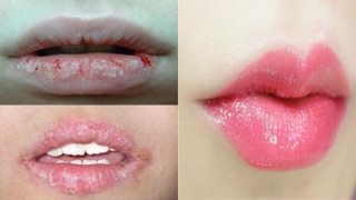 Son dưỡng môi Biodmar