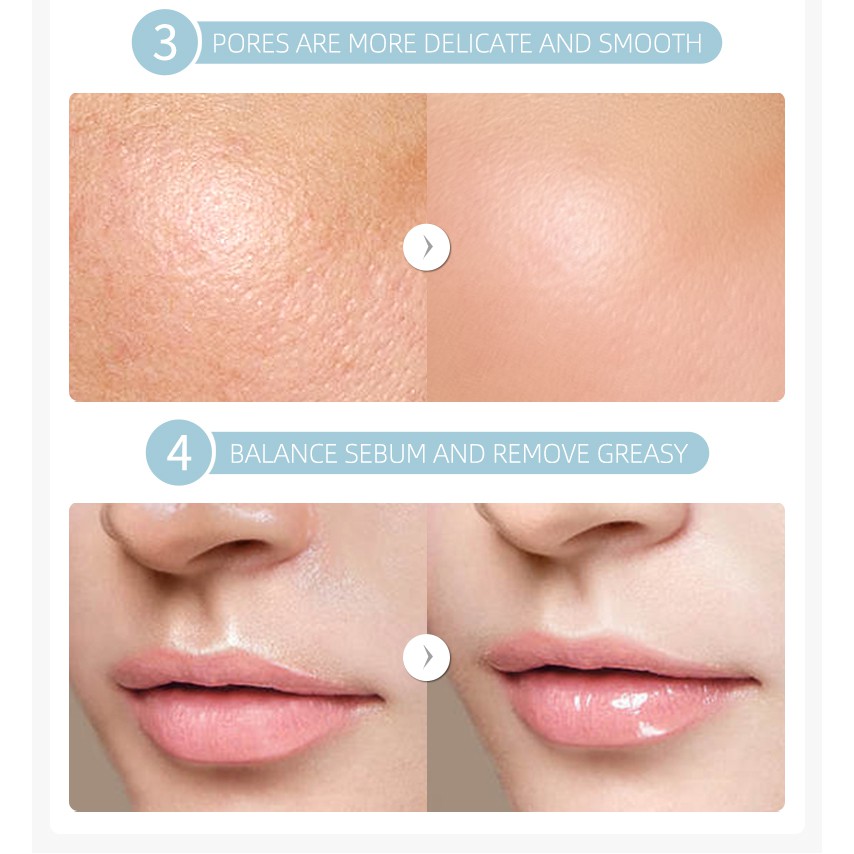 LAIKOU Sakura 24K Vitamin C Face Serum 4pieces x 17ml