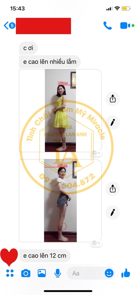 Tinh Chất Tăng Chiều Cao Miracle