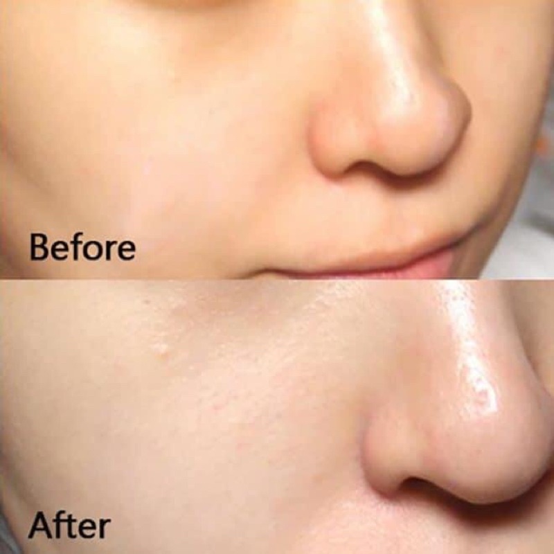 Tẩy tế bào chết Huxley, tẩy da chết mặt Huxley Scrub Mask Sweet Therapy 30g | BigBuy360 - bigbuy360.vn