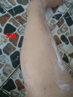 Kem tẩy lông