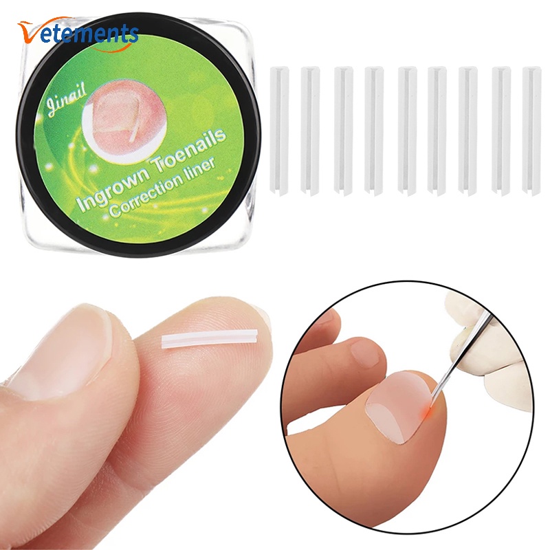 Miếng Đệm Lót Chỉnh Hình Làm Thẳng Móng Chân Tiện Dụng