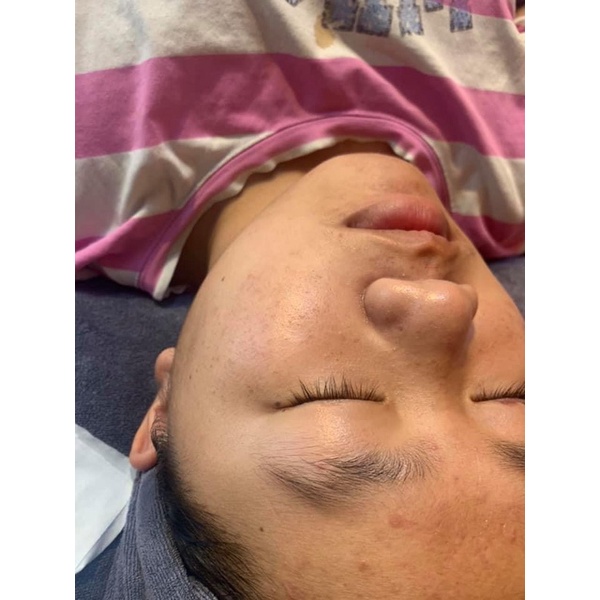 Serum đường đen Black sugar ♥️ Chính Hãng | BigBuy360 - bigbuy360.vn