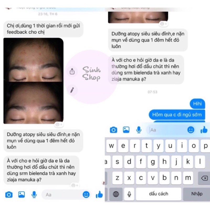 Kem Chăm Sóc Da ZiajaMed Atopy Azs 50ml balan