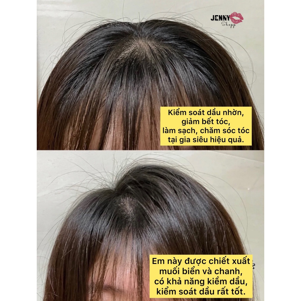 Combo Lược & Tẩy Da Chết Cho Tóc Và Da Đầu Jiorniee Head Series