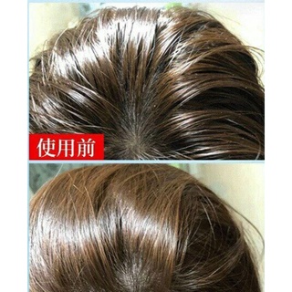 Dầu Gội Khô ISSY 150ml [Dạng Xịt]