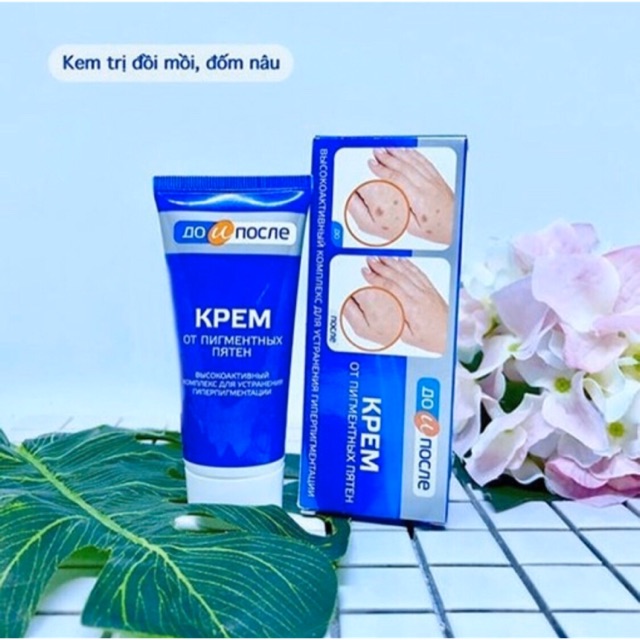 Kem trị đồi mồi nga