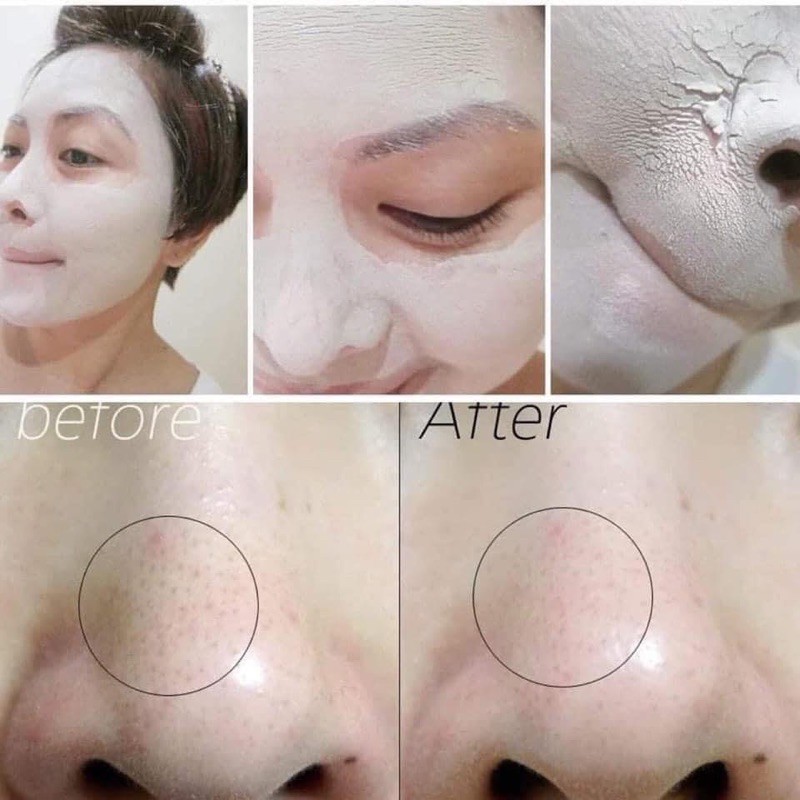 Mask đất sét săn sale