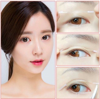 Chỉ kích mí siêu mảnh