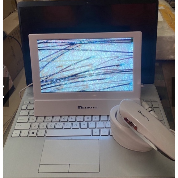 Máy soi da Meiboyi 3 chức năng, Máy soi da cầm tay IPAD màn hình 11inch 3 chế độ soi có chụp ảnh